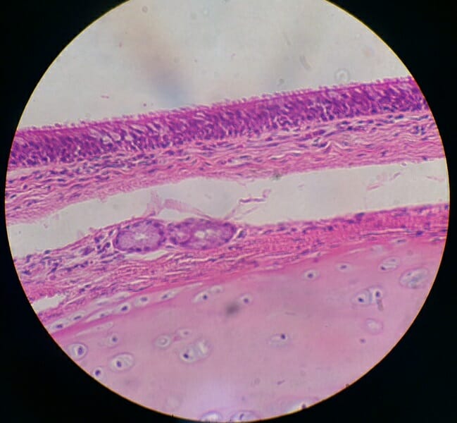 Pseudostratified Columnar Epithelium Definition And Function 