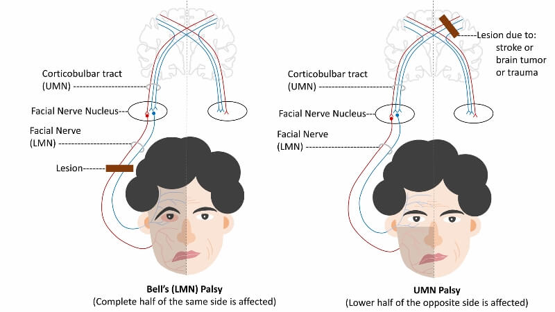 Facial Nerve The Definitive Guide Biology Dictionary