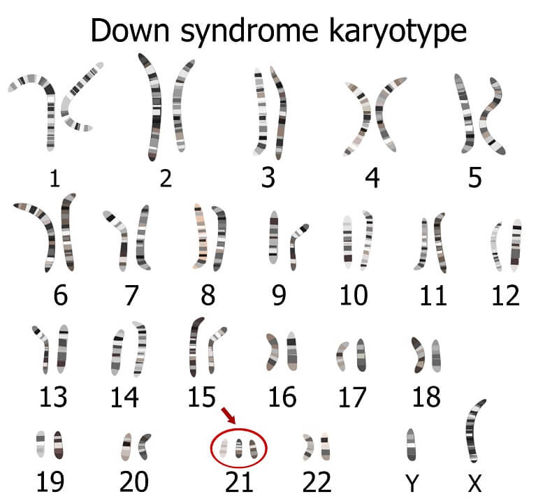 chromosome nondisjunction