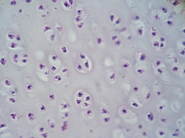 hyaline cartilage connective tissue slide