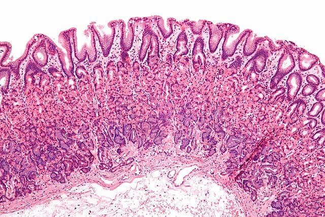 Membrana mucosa (mucosa): y ejemplos - Gen Curioso
