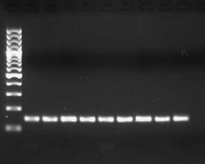 Gel electrophoresis