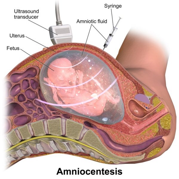 Amniotic Fluid Definition and Function Biology Dictionary