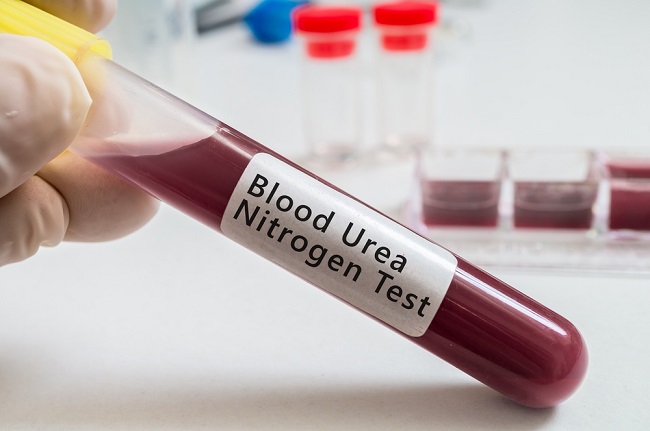 Blood urea nitrogen (BUN) test