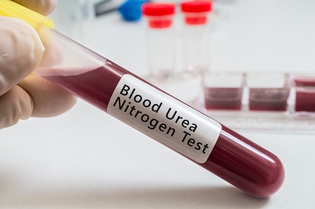 bun blood urea nitrogen normal range