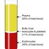 What is Irradiated Blood | Biology Dictionary