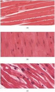 Skeletal Smooth Cardiac