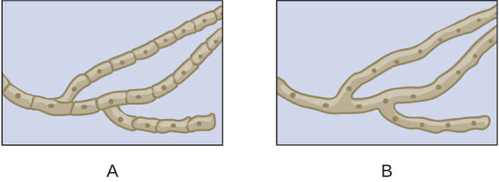 Septate vs Non-Septate Hyphae | Biology Dictionary