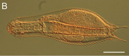 Chaetonotidae