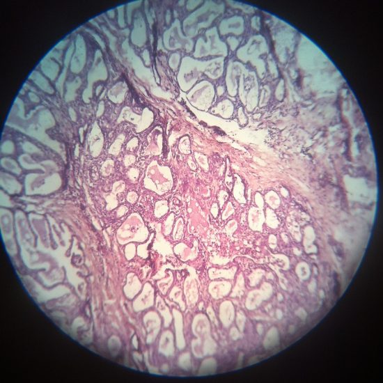 Lactating Mammary Gland