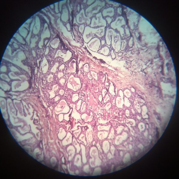 Stratified Cuboidal Epithelium - Definition and Function | Biology ...