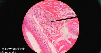 Stratified Cuboidal Epithelium Sweat gland histology