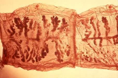 Internal anatomy of a tapeworm