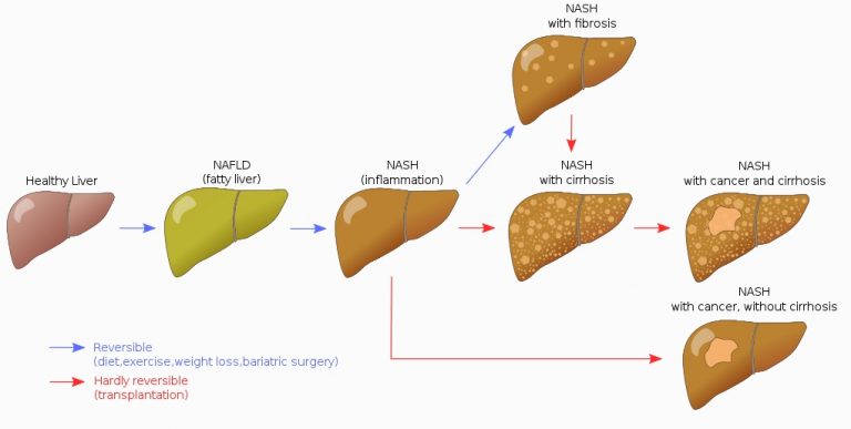 Bile Salts - The Definitive Guide | Biology Dictionary