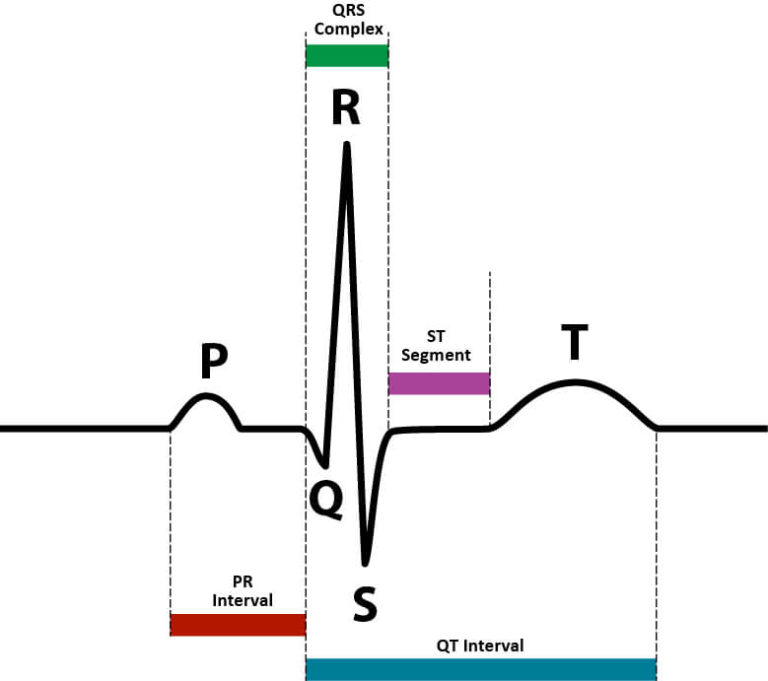 Junctional Rhythm - The Definitive Guide | Biology Dictionary