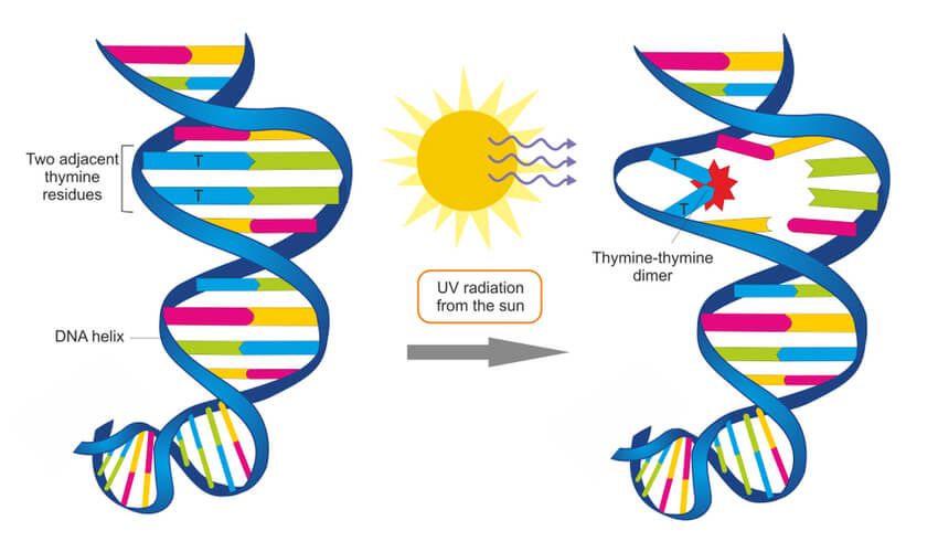 Normal DNA pointing to damaged DNA with thymine dimer after UV radiation