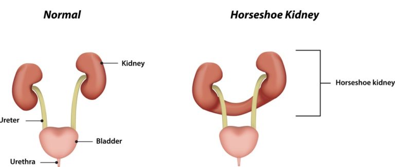 The Kidney - The Definitive Guide