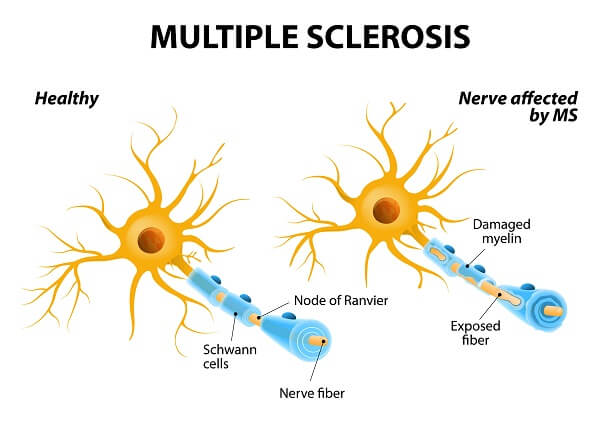 satellite cells and schwann cells