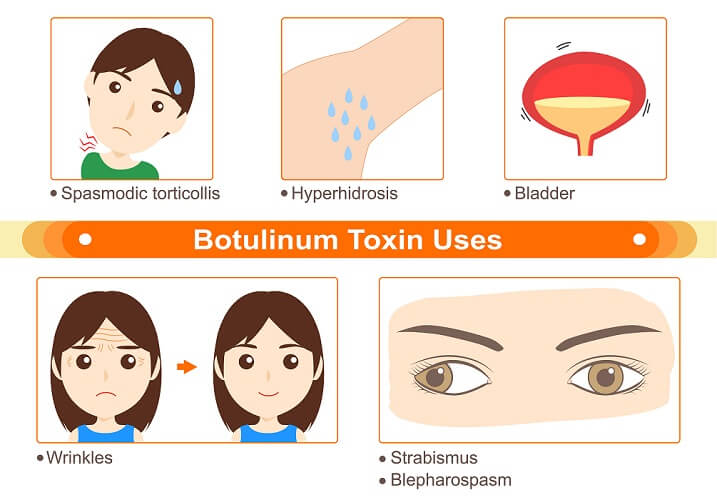 botulinum toxin nikotin patkány