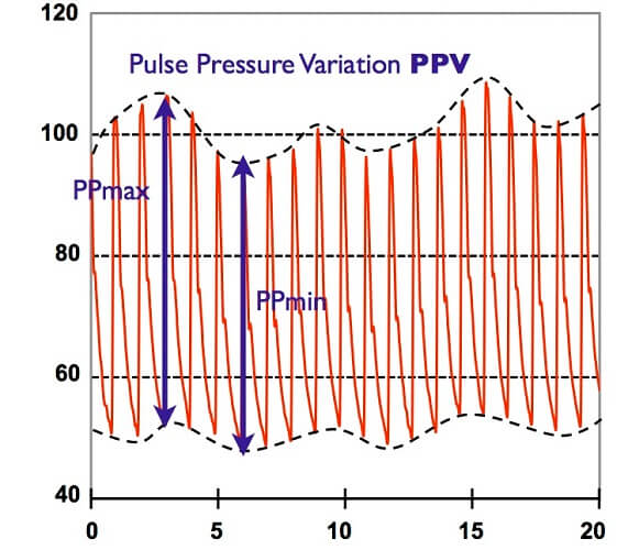 Pulse deals pressure calculation