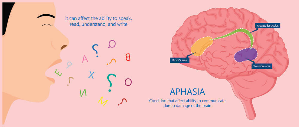What Causes Aphasia
