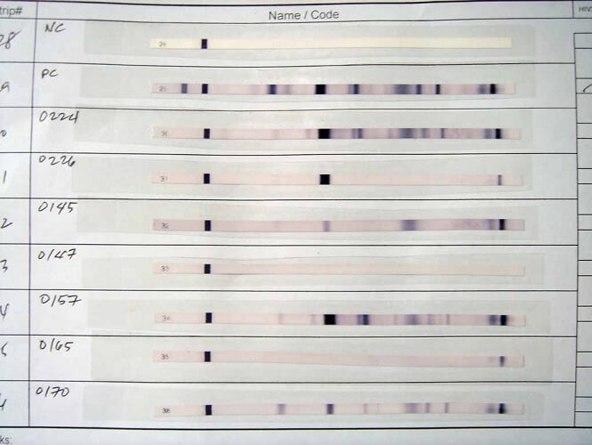 western blot hiv quest lab name