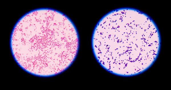 gram positive vs gram negative bacteria lps