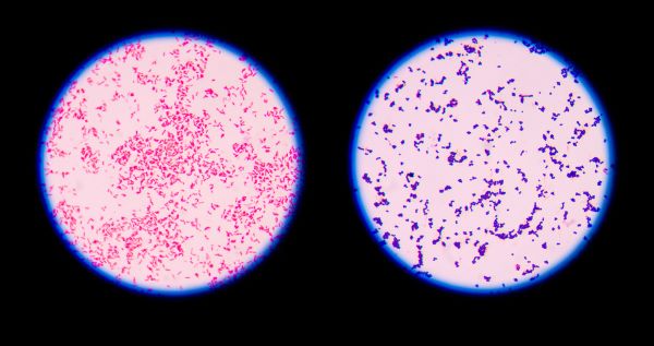 gram positive vs gram negative bacteria diagram