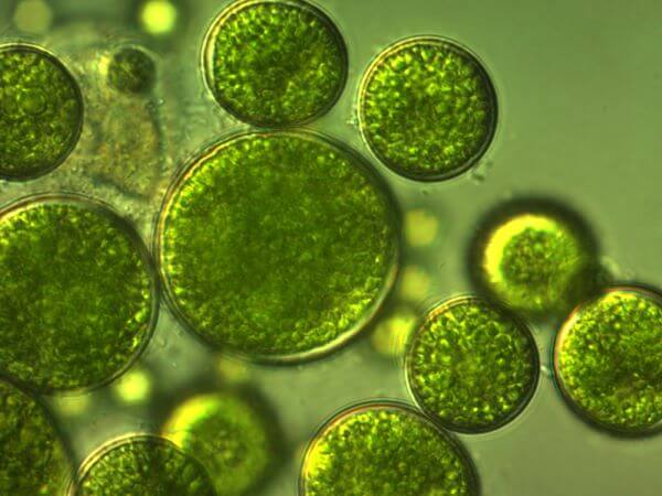 Protista Kingdom Cell