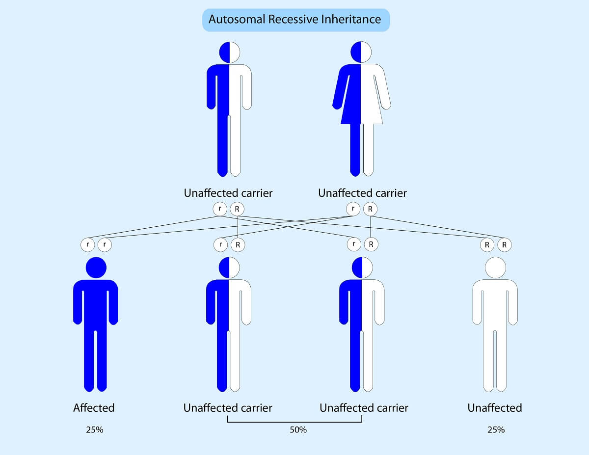 is triple x syndrome recessive or dominant