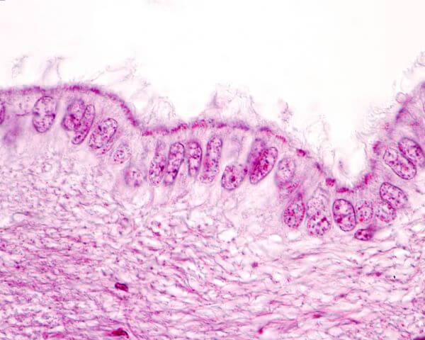 ependymal cells histology