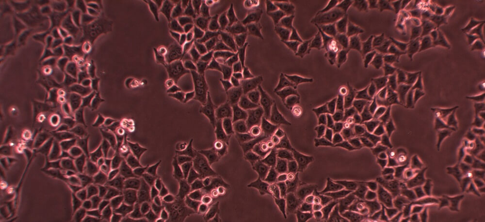 HeLa Cells Morphology