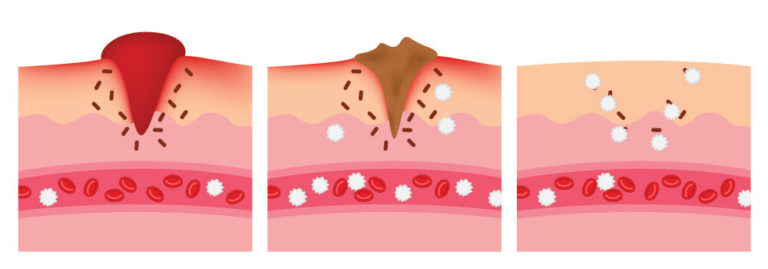 White Blood Cell - The Definitive Guide | Biology Dictionary